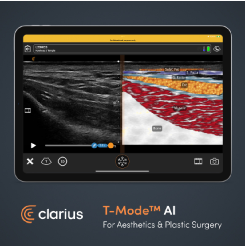 Clarius Invents a New Way to Help Clinicians Instantly Identify Ultrasound Anatomy