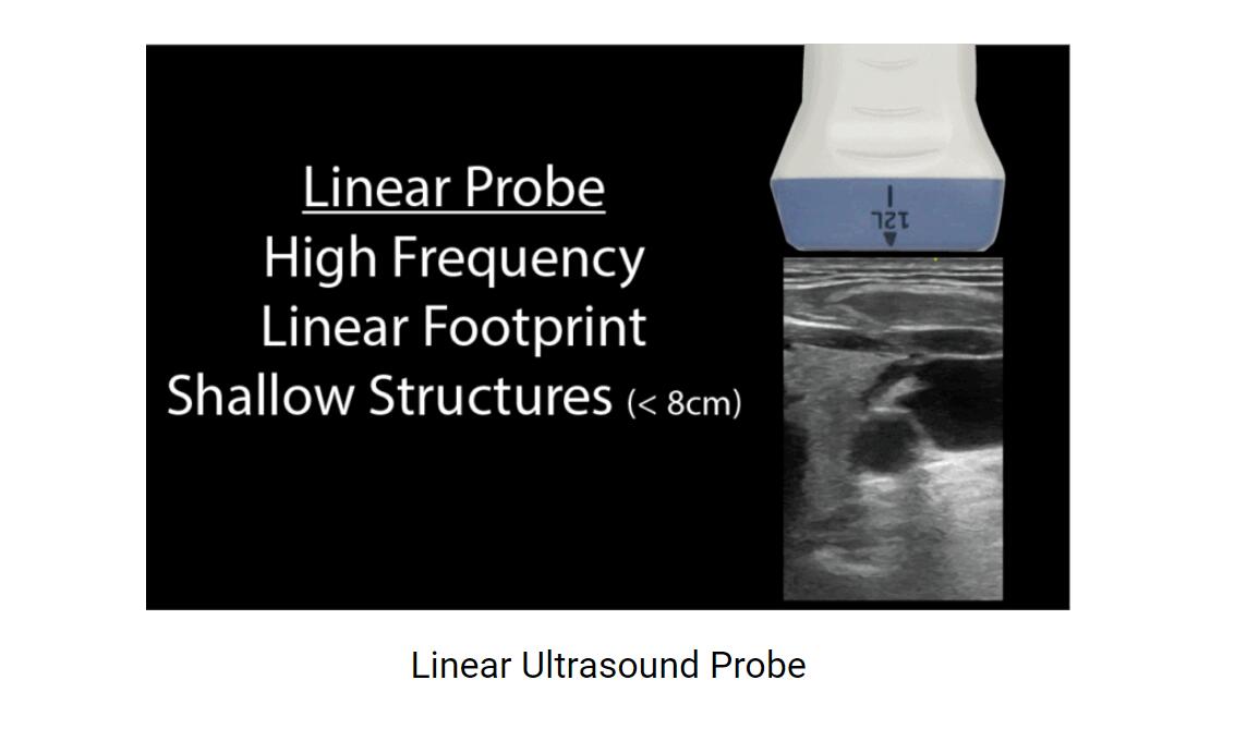 Choosing the Right Ultrasound Probe /Transducer for the Body Examination