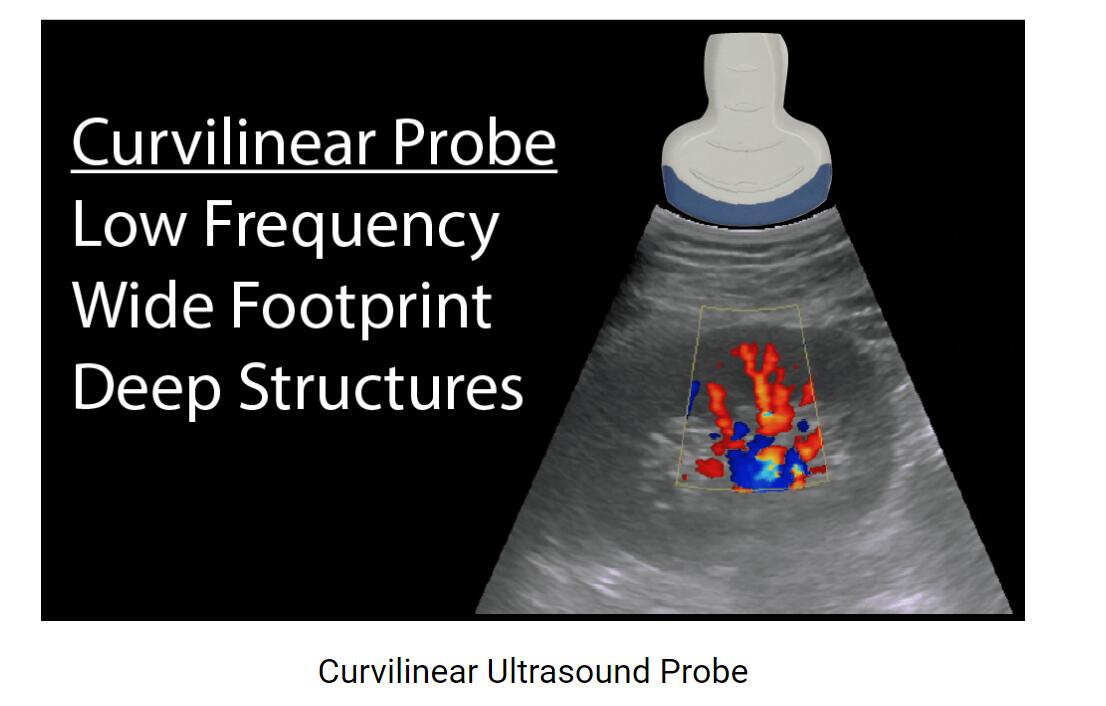 Choosing the Right Ultrasound Probe /Transducer for the Body Examination