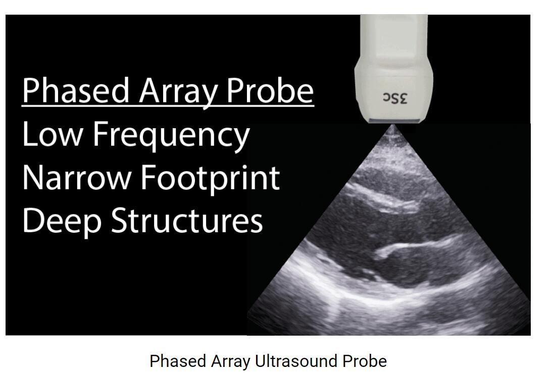 Choosing the Right Ultrasound Probe /Transducer for the Body Examination