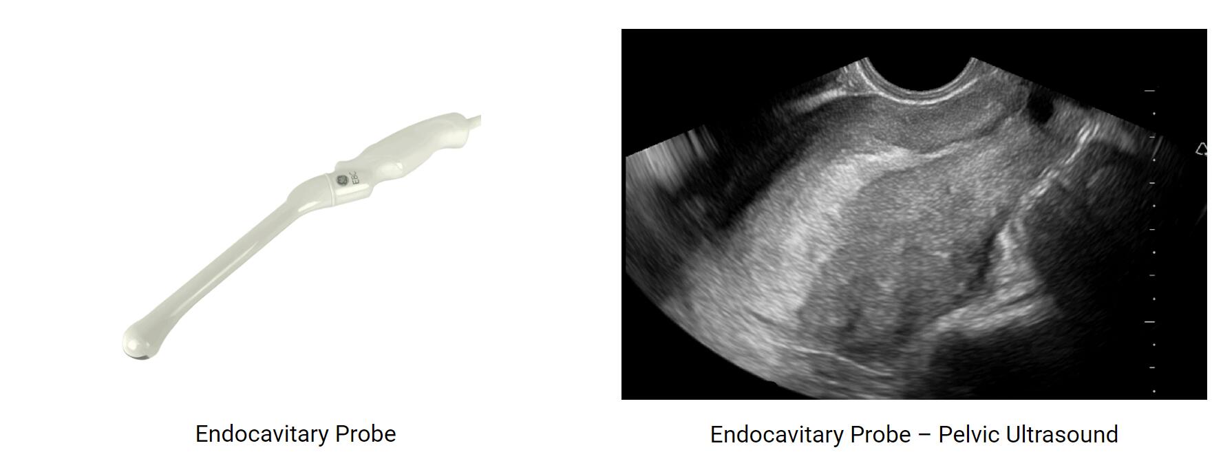 Choosing the Right Ultrasound Probe /Transducer for the Body Examination